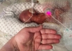 Bebeluș de 500 de grame, la Spitalul Hârșova