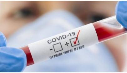 Numărul cazurilor de COVID-19, în creștere