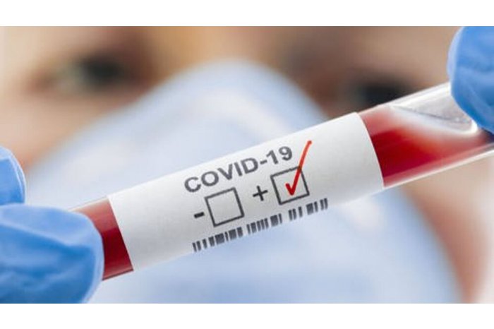 Numărul cazurilor de COVID-19, în creștere